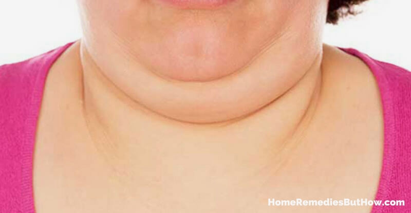 Get rid of Double Chin