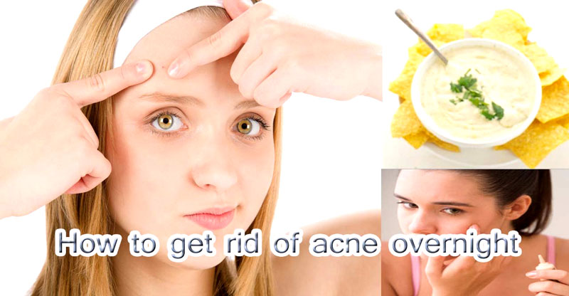 Get Rid Of Pimples Overnigh