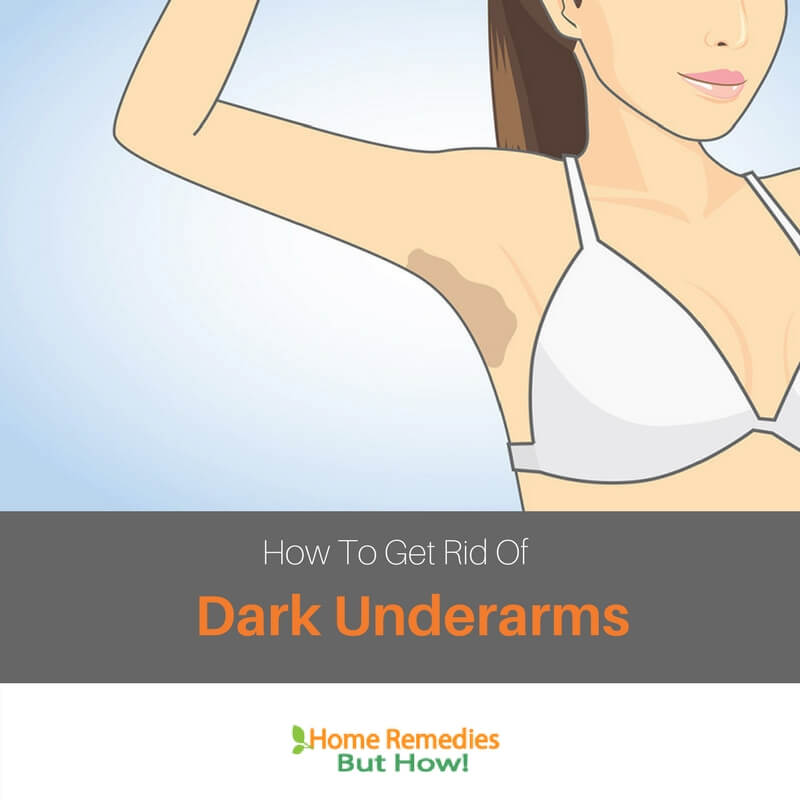 Get Rid Of Dark Underarms Overnight